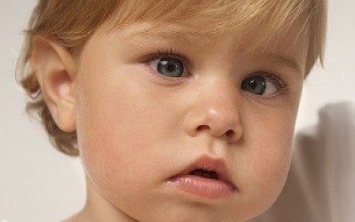 Šilhání (strabismus) u dětí